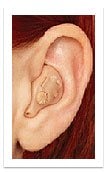 Photo of in the ear aid that fills the entire outer portion of the ear. 