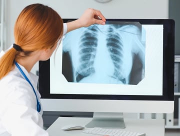 A physician examines an x-ray of a patient's lungs.