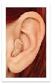 Photo of ear with half shelf hearing aid.