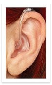 Photo of ear with hearing aid behind the ear.